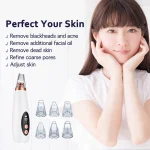 Electric Blackhead Remover Vacuum - Portable Pore Cleansing Beauty Tool - Image 6
