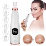 Electric blackhead remover, pore cleaner, acne remover, oil remover, facial beauty instrument, blackhead remover - Image 2