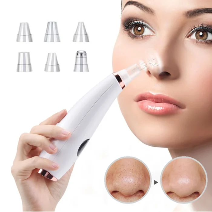 Electric blackhead remover, pore cleaner, acne remover, oil remover, facial beauty instrument, blackhead remover - Image 1