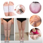 Kinoki Cleansing Detox Foot Herbal Natural Herbal Deep Cleansing Ginger Detoxification Improve Sleep Dehumidification Foot Patch - Image 5