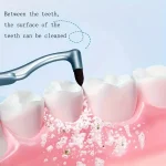 Manual Tooth Stain Remove Tartar/Tea/ Smoke Stains Interdental brush Powerfree Operation Orthodontic Toothbrush Oral Care Tool - Image 6