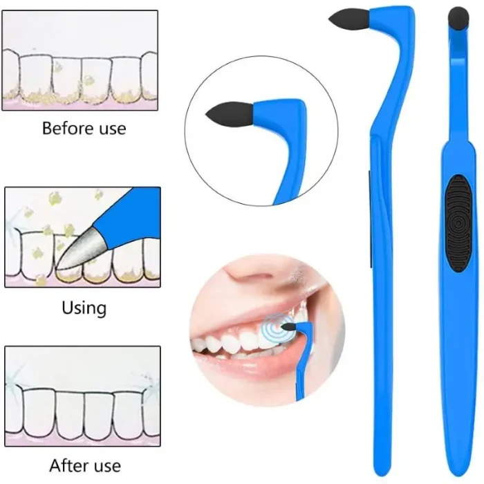 Manual Tooth Stain Remove Tartar/Tea/ Smoke Stains Interdental brush Powerfree Operation Orthodontic Toothbrush Oral Care Tool - Image 2